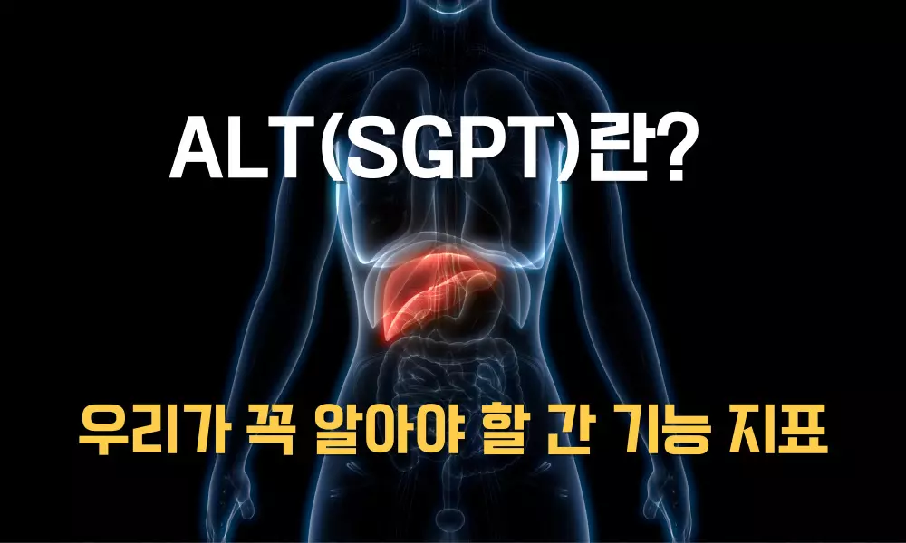 ALT(SGPT)